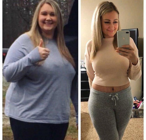 Transformação antes e depois - emagrecimento